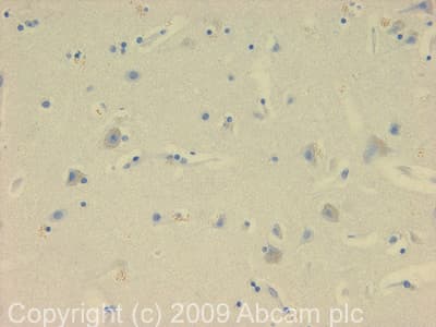 Anti-NDP52 antibody(AB68588)