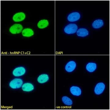 Hnrnp C1 C2 Antibody 4f4 Ab316365  Immunocytochemistry Immunofluorescence Img426789