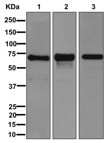 Anti-Perilipin-1 antibody [EPR3753(2)](AB172907)