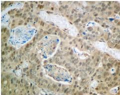 Proteasome Subunit Beta Type 2 Psmb2 Antibody Epr88262b Bsa And Azide Free Ab249366  Immunohistochemistry Formalin Pfa Fixed Paraffin Embedded Sections Img117371