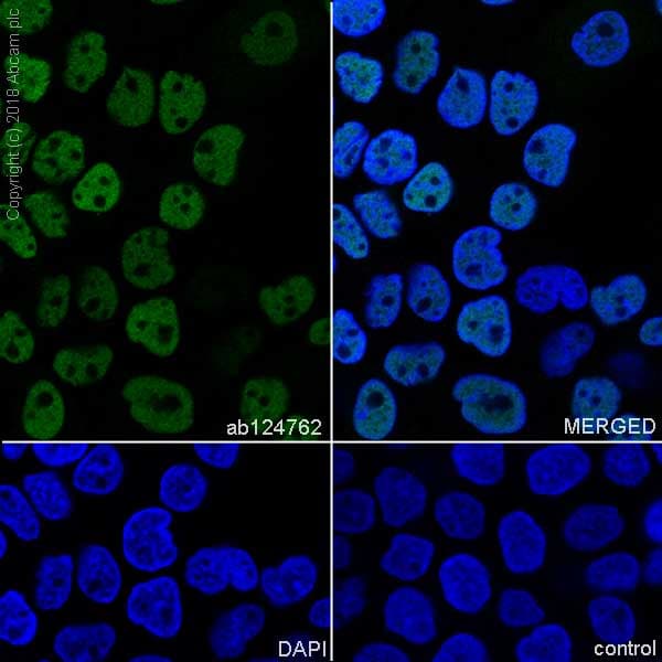 Anti-p63 antibody [EPR5701](AB124762)
