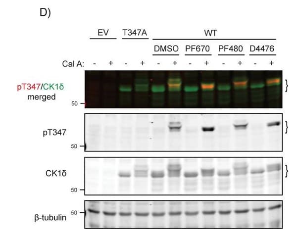Anti-beta III Tubulin antibody [EP1569Y] - Neuronal Marker(AB52623)