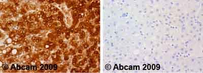 Anti-Fibrinogen antibody(AB34269)