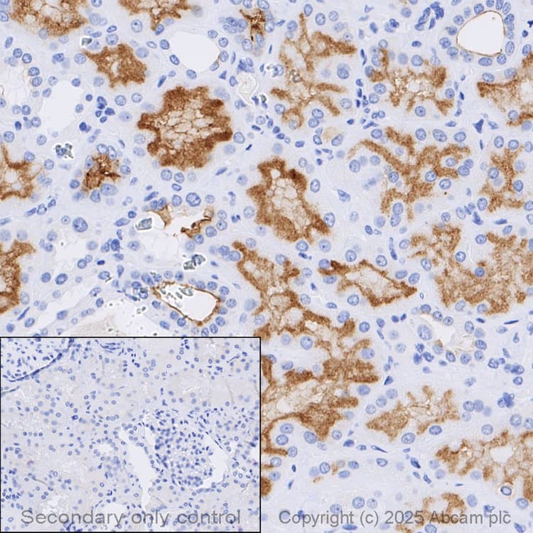 Anti-P Glycoprotein antibody [EPR10364-57](AB170904)