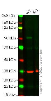 Anti-beta Catenin antibody [E247] - ChIP Grade(AB32572)