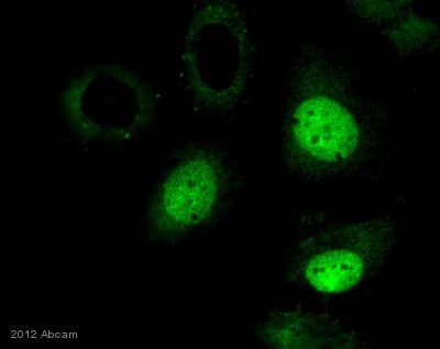 Anti-Histone H3 (tri methyl K36) antibody - ChIP Grade(ab9050)