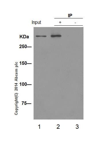 Anti-ATM (phospho S1981) antibody [EP1890Y](AB81292)