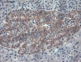 Anti-PDX1 antibody [OTI2A12](AB84987)