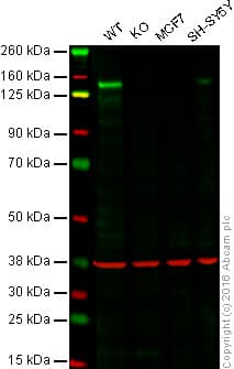 Fgfr1 Antibody Epr806y Low Endotoxin Azide Free Ab206382  Western Blot Img141214