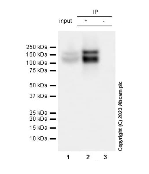 Trkc Antibody Epr22959 404 Ab313761  Immunoprecipitation Img419009