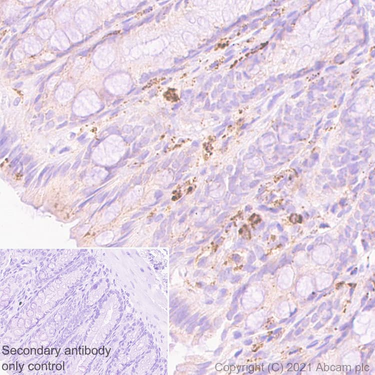 Socs3 Antibody Epr24090 74 Ab280884  Immunohistochemistry Formalin Pfa Fixed Paraffin Embedded Sections Img114109