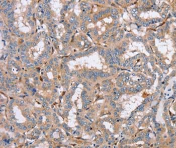 Ppm1f Popx2 Antibody Ab200394  Immunohistochemistry Formalin Pfa Fixed Paraffin Embedded Sections Img111761