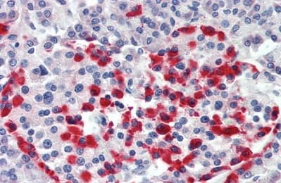 Anti-ITGB6 antibody(AB233519)