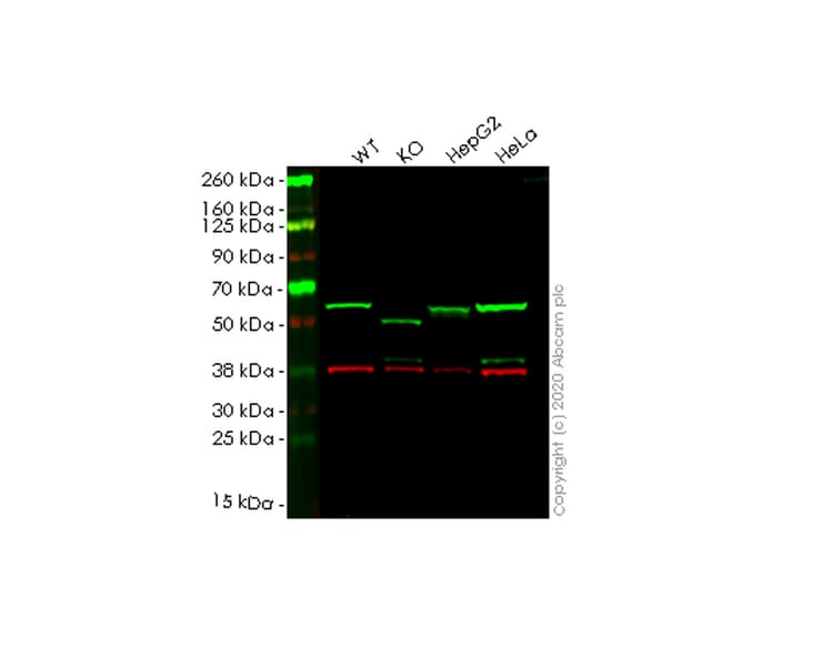 Sqstm1 P62 Antibody Epr18351 Autophagosome Marker Ab207305  Western Blot Img146378