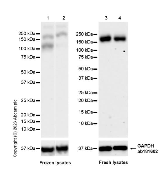 Anti-SCAP antibody [EPR26242-60](AB308060)
