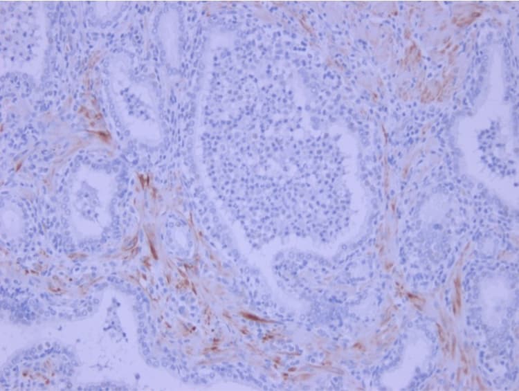 Anti-IL-6 antibody [1.2-2B11-2G10](AB9324)