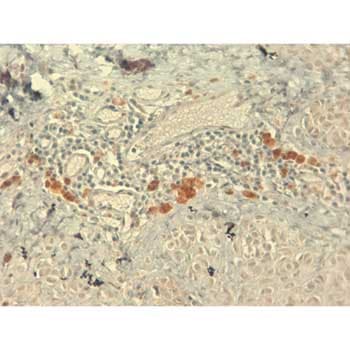 Anti-IGF1 antibody [7973](AB176523)