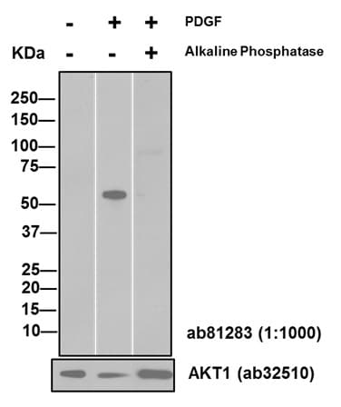 Anti-AKT1 (phospho S473) antibody [EP2109Y](AB81283)