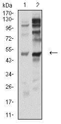 Anti-P2Y12 antibody [1C2A9](AB233760)