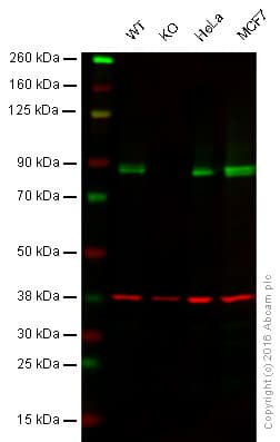 Anti-CPT1A antibody [8F6AE9](AB128568)