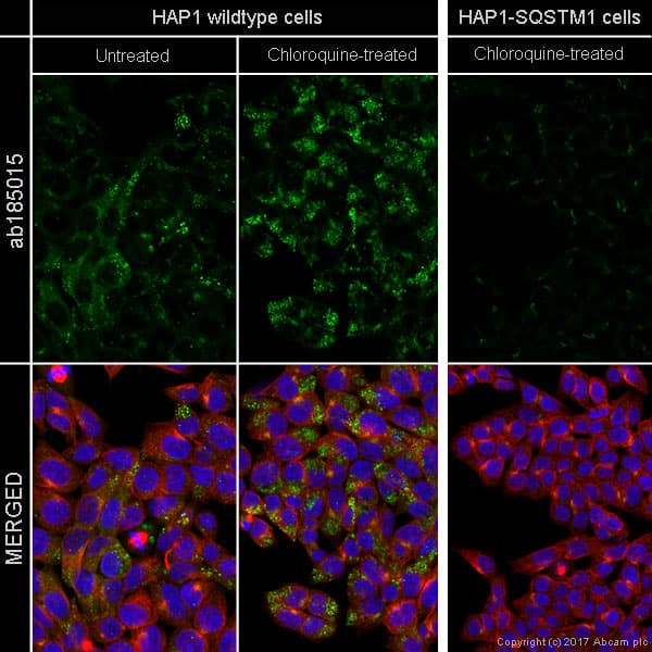 Alexa Fluor® 488 Anti-SQSTM1 / p62 antibody [EPR4844] - Autophagosome Marker(AB185015)