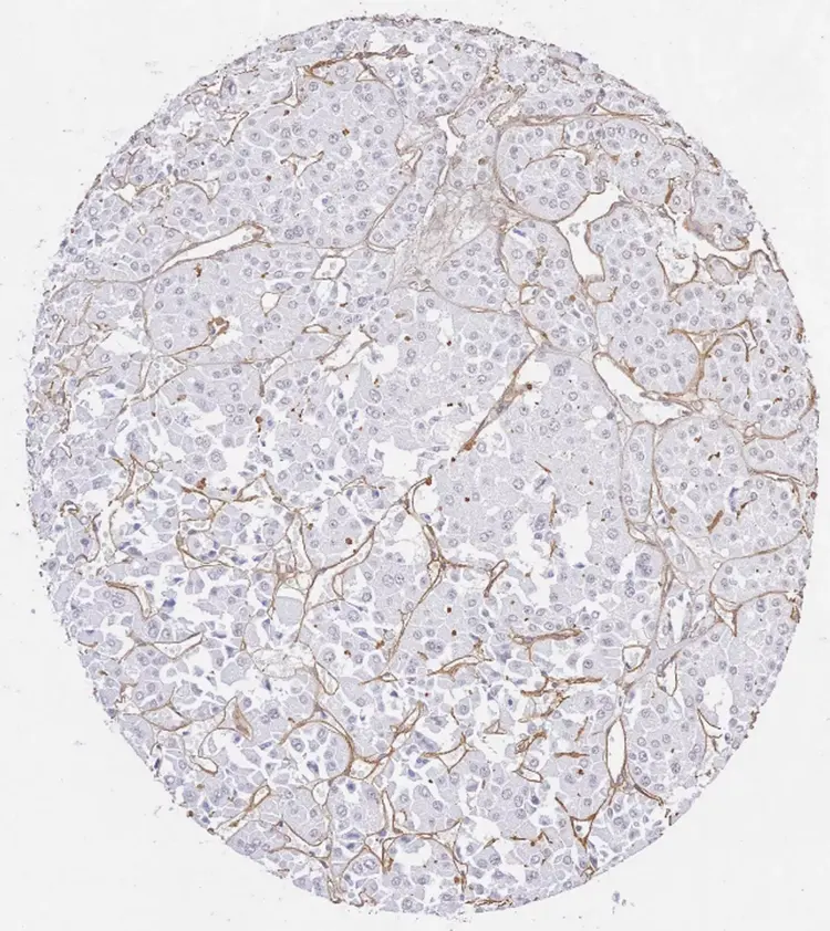 Anti-Collagen IV antibody(AB6586)