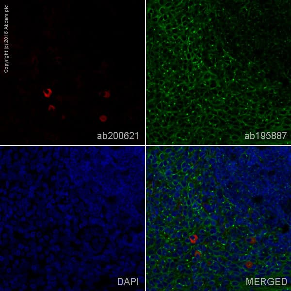 Rabbit Monoclonal H19 5 Human Kappa Light Chain Alexa Fluor 647 Ab200621  Immunohistochemistry Formalin Pfa Fixed Paraffin Embedded Sections Img20631