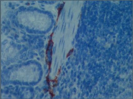 Anti-LYVE1 antibody - BSA and Azide free(AB14917)