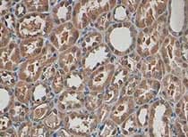 Timp3 Antibody Ab93637  Immunohistochemistry Formalin Pfa Fixed Paraffin Embedded Sections Img95719