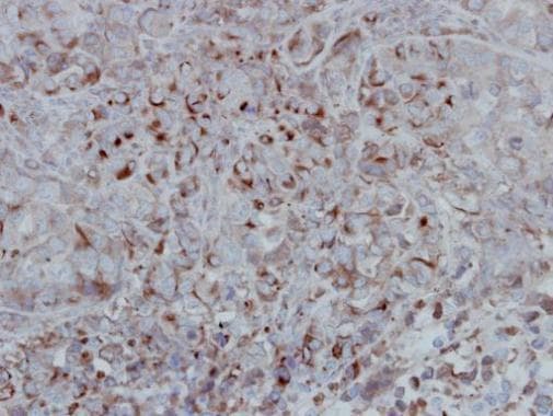 Anti-GSK3 beta antibody(AB227208)
