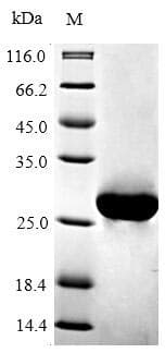 Recombinant Mouse Bcl-2 protein (His tag)(AB235687)
