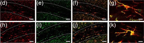 Anti-TMEM119 antibody [28-3] - Microglial marker(AB209064)