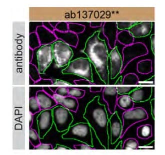 Anti-RAB7 antibody [EPR7589](AB137029)