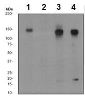Anti-ErbB2 / HER2 (phospho Y877) antibody [EP2324Y](AB108371)