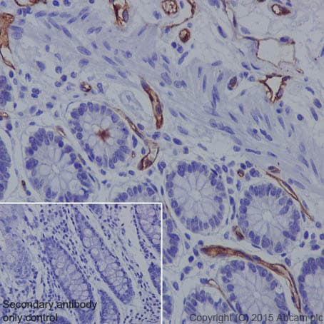 Anti-Claudin 5 antibody [EPR7583](AB131259)