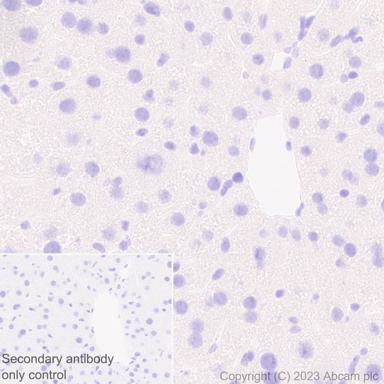 Anti-Rfx Cas13d (N-term) antibody [EPR23965-31](AB314741)