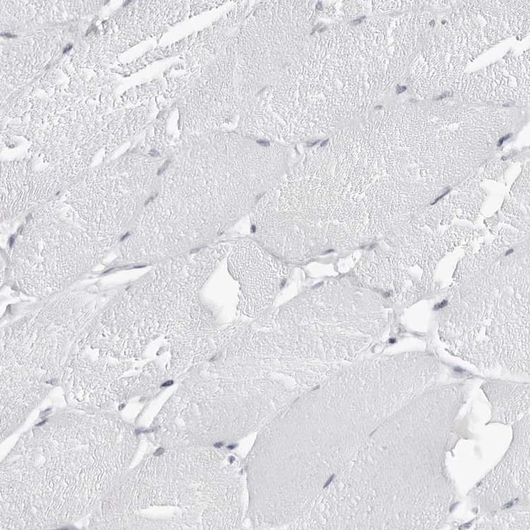 Espin Antibody Ab254774  Immunohistochemistry Formalin Pfa Fixed Paraffin Embedded Sections Img86122