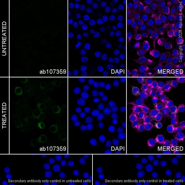 Alexa Fluor 594 Alpha Tubulin Antibody Ep1332y Microtubule Marker Ab202272  Immunocytochemistry Immunofluorescence Img446841
