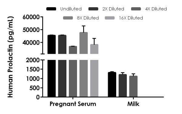 Human Prolactin/PRL ELISA Kit(AB226901)