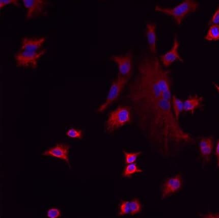 Anti-LMAN1 antibody(AB32583)