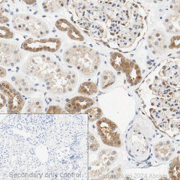 Anti-TSG101 antibody [EPR7130(B)](AB125011)