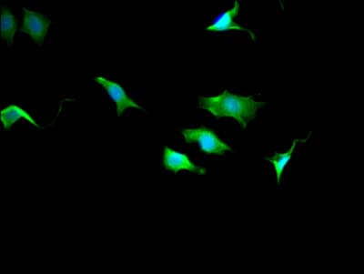 Tctp Antibody 10a9 Ab314167  Immunocytochemistry Immunofluorescence Img419636