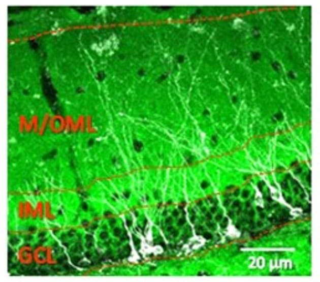 Anti-Fade Fluorescence Mounting Medium - Aqueous, Fluoroshield(AB104135)