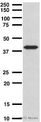 Anti-TTF1/Nkx2-1 antibody [EP1584Y](AB76013)