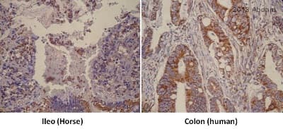 Anti-SOD2/MnSOD antibody(AB13534)