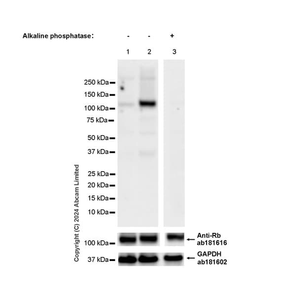 Anti-Rb antibody [EPR17512](AB181616)
