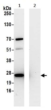 Anti-HPRT antibody(AB245397)