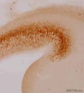 Anti-TBR2 / Eomes antibody(AB23345)