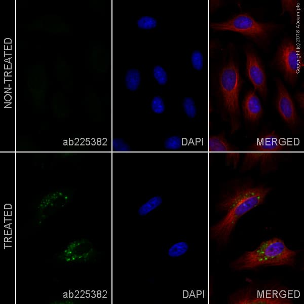 Alexa Fluor® 488 Anti-LC3B antibody [EPR18709] - Autophagosome Marker(AB225382)