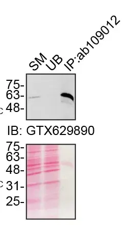 Anti-SQSTM1 / p62 antibody [EPR4844] - Autophagosome Marker(AB109012)
